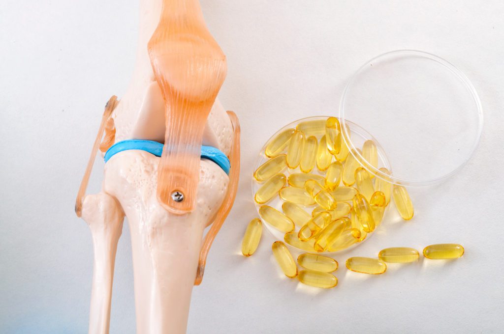 Osteoarthritis and how a supplement combo may help
